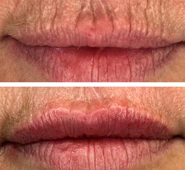 Tratamientos Faciales TheCliniq